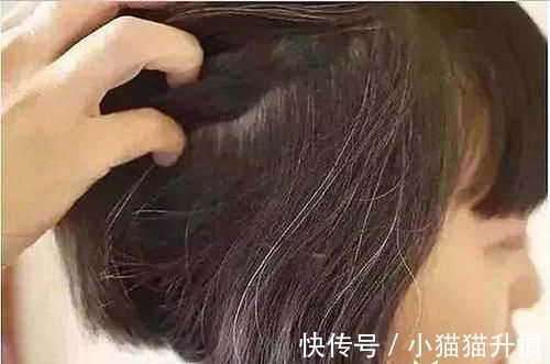 扁鹊内经|肝若硬化，头先知？头部若出现5个异常，建议：去医院做肝CT检查