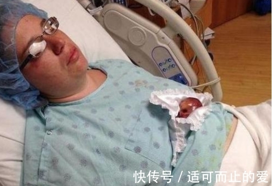 早产儿|美国一女婴出生仅25厘米,体重280克,16年过去现已成女神