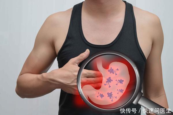 胃癌是拖出来的?医生常说:4种小病是祸根,及时治疗避免恶化