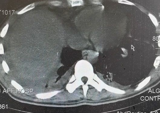 药引|头皮发麻！男子吃这个东西当药引，结果身体里长满寄生虫！