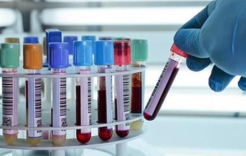 癌症|为什么动不动就要做血常规检查？做一次血常规，能查出什么？