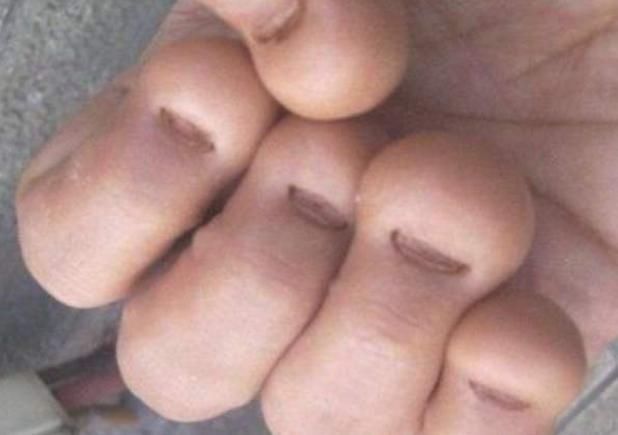 奶奶|3岁小男孩爱啃指甲，妈妈紧急纠正，奶奶：不就吃个手，有啥要紧