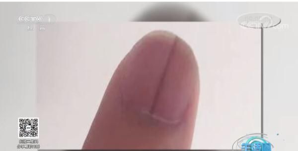 杵状甲|请低头:长这几种指甲的人注意了