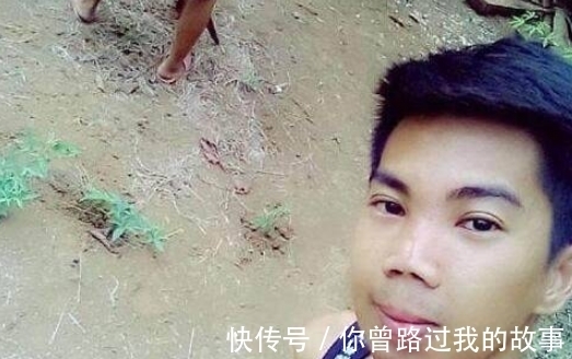 小伙|小伙花费70元整容,结果整容失败致脸部溃烂,帅小伙变成丑男