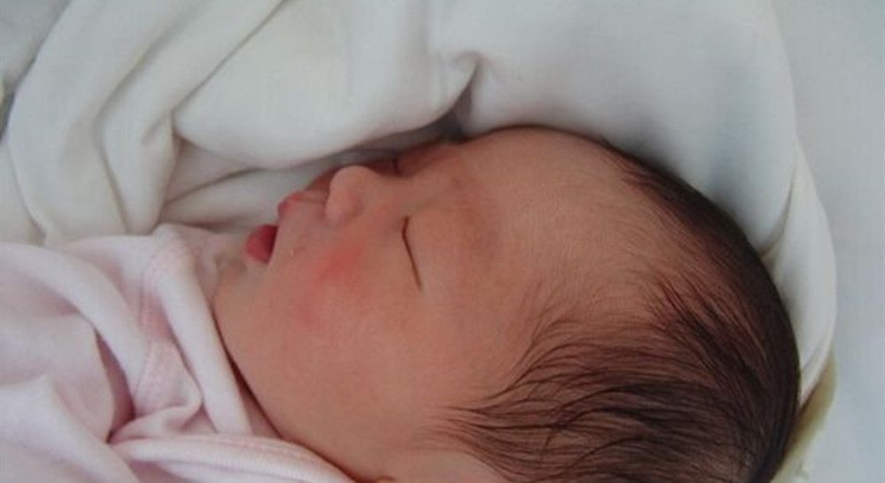 导致孩子|孩子1岁脸上“产钳印”不消,找医生被反驳,宝妈无言以对