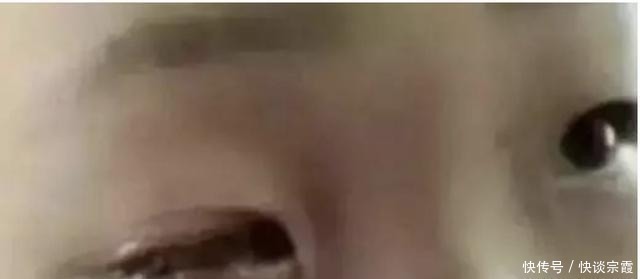 孩子|20分钟孩子眼球被溶化!医生的呼吁为所有家长敲响警钟