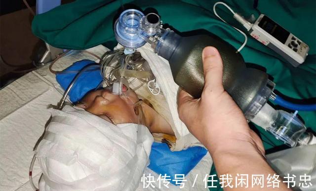 医科大学|男孩发生意外失去半个脑壳,父亲自责,只想给孩子一个正常脑袋