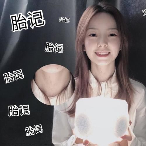 包容度|被“胎记”耽误前程的明星,陈卓璇能用粉底遮盖,他却令人可惜