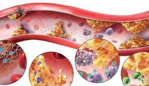 血管最怕堵，饭后常做这3个小动作，血管将永远畅通无阻