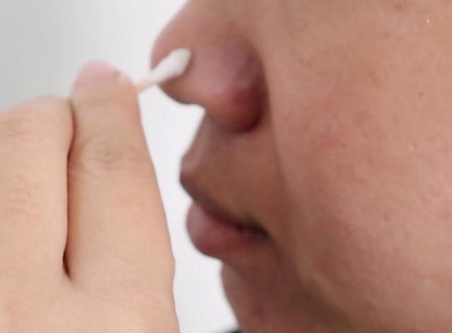 把红霉素软膏抹鼻子上效果好,红霉素软膏3个神奇妙用,值得尝试