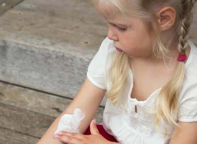 湿疹|宝宝湿疹的3个治疗误区，别再走“弯路”了！