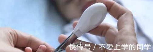 剪指甲|给婴幼儿剪指甲可不简单, 我的孩子被剪成了甲沟炎!
