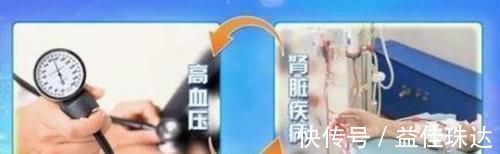 小张|90后小伙患高血压5年竟致肾衰竭,医生叹息:3方面早注意