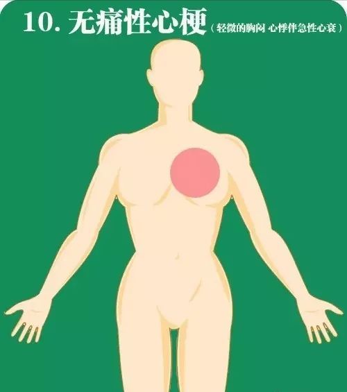 心梗|急性心梗10个常见疼痛部位及图解！