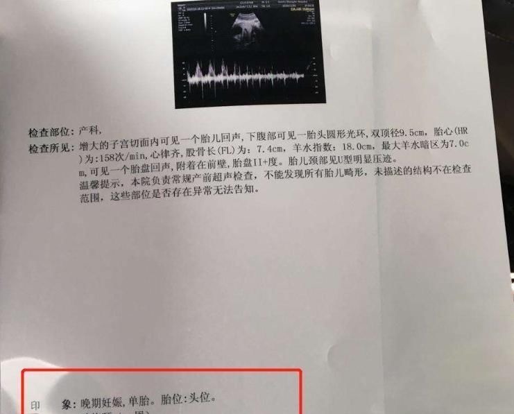 孕期|怀孕后,4个“不良习惯”可能会让羊水变浑浊,孕妈别大意