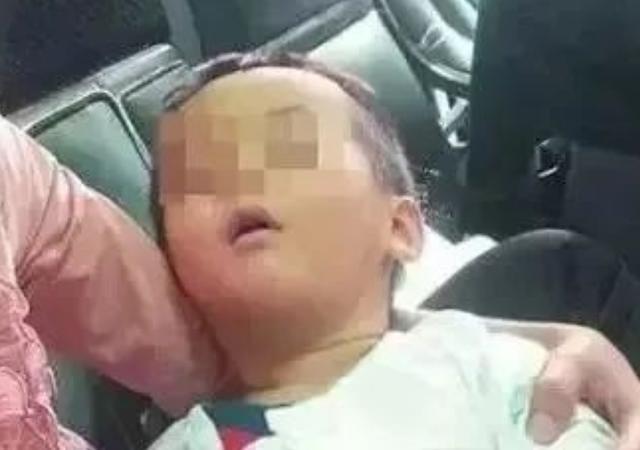 皮蛋|4岁孩子铅中毒,智商恐再难发育,医生2种食物尽量别给娃吃