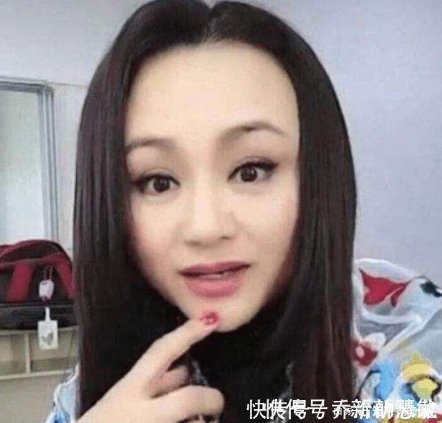 私人订制|被玻尿酸毁掉的女星,容貌前后变化太大,一般人根本认不出!