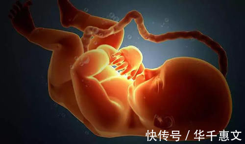 胆汁淤积|产检查出羊水浑浊?孕妇别担心,提前了解三个原因,避免影响胎儿