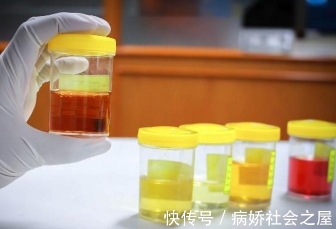 喝水|晨起2大表现可能是肝脏在“呼救”！希望你早发现，不然等着后悔