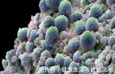 得癌|于加军答:为什么会得癌?"癌"究竟是什么?