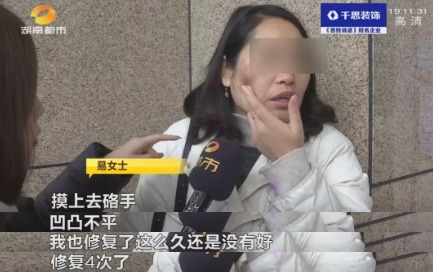 修复 女子花5000元祛斑后懊恼被“毁容”,工作人员:正常现象