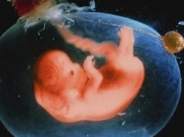 孕期综合症|孕期做到“4不碰”,有利于保持羊水“清澈”,胎儿住着更干净