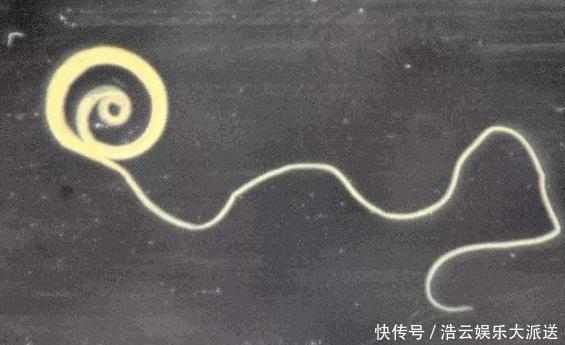 孩子|4种常见水果,有营养但含有大量寄生虫,父母不能让孩子多吃