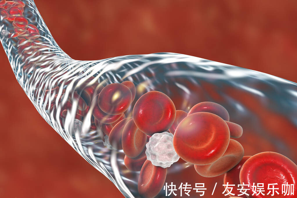 心脑血管疾病|最新研究:控制饮食,来降低“坏血脂”,能大大节约医疗费用!