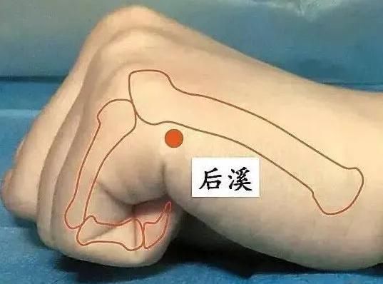  牢记全身疾病特效穴，专穴专用！