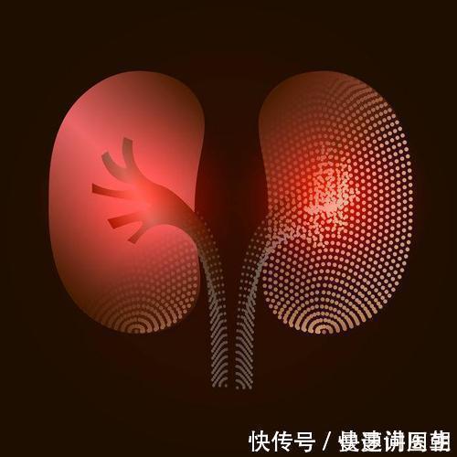 尿蛋白|尿带泡沫就是蛋白尿？若是这几种，不代表身体健康出问题