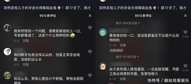 上颌|17岁男孩长尖牙，妈妈吐槽“吸血鬼”，网友被咬一口很难辨别