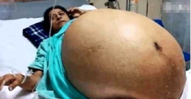 女子|泰女子怀孕后体重增加73斤,接生完11个婴儿,医生直呼不可能