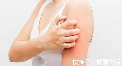 危害|皮炎危害不简单 若不认真应对终将害了你自己