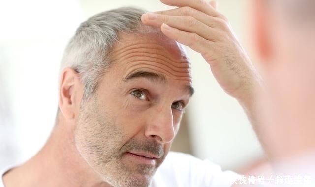 黑色素|长了白头发别着急,用上3种方法,可能自然变黑