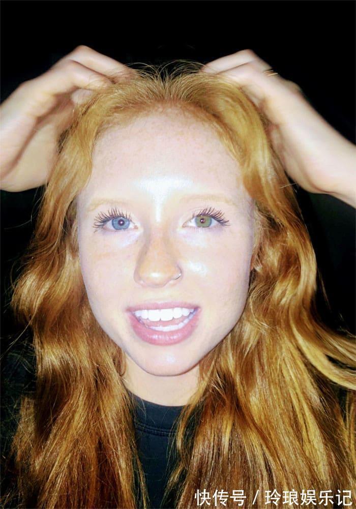 脚趾|19个“被上帝挑选过”的特殊基因人类,怎么梳都不整齐的头发