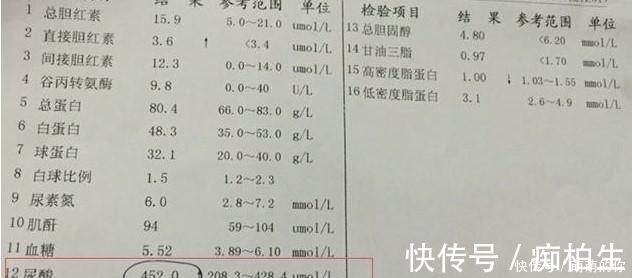 高尿酸|尿酸不超540,不吃药也能降,学会吃3样东西,尿酸主动降下来