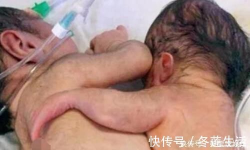 婆婆|孕妇产检时是双胞胎,孩子出生时,全家人失声痛哭乱作一团