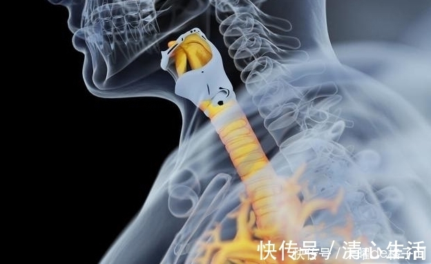 疾病|过敏性支气管炎是什么导致的,3大原因导致过敏性支气管炎