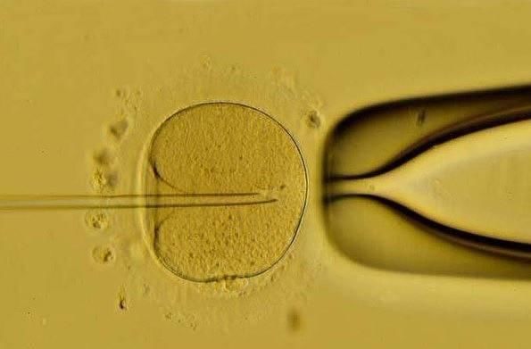 胚胎|揭秘试管婴儿全过程(附图)，看完后心疼女性一万遍