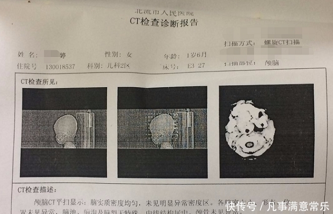 癫痫|2岁孩子突然“中邪”，四肢抽搐，口吐白沫，到医院才发现病因！