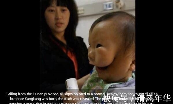 妈妈|宝宝安全出生,可妈妈看到宝宝的样子失声痛哭!