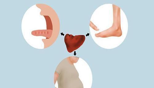 祛湿|湿气到底是怎么来的洗澡会加重体内湿气如何有效祛湿