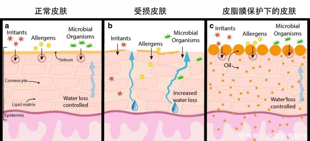 角质层|皮肤“外油内干”还老爱长痘,怎么破?