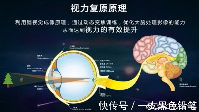 近视眼|近视眼能自然恢复?视力自然疗愈有说法吗?