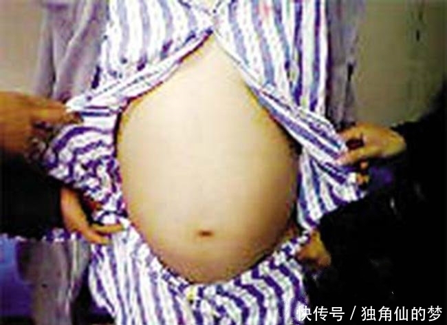 西瓜|12岁少女肚子“大如西瓜”家人以为怀孕,医生一席话令家人崩溃!