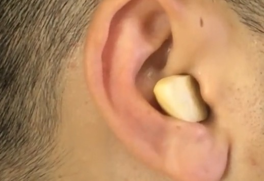 大蒜|大蒜放耳朵里太厉害了，10个人9个不知道，学完都会感谢我