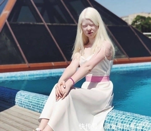 白化病|一对罕见的“月亮姐妹”,被人嘲讽14年,拍完一组照片后惊艳众人