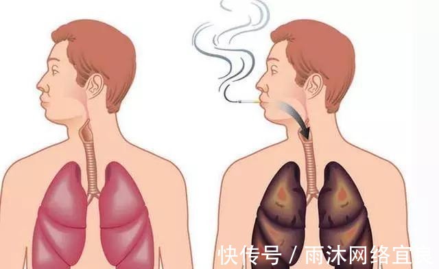 尼古丁|戒烟会造成这样的不健康倾向, 但同样是一个好的现象