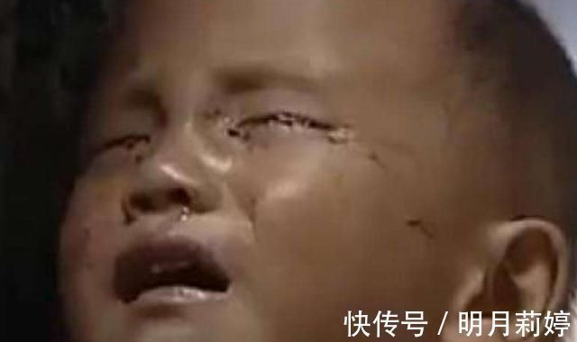 父子俩|3岁孩子每天玩玩具车,导致眼睛几乎失明,这类玩具家长别再买了