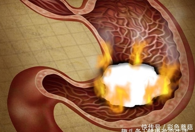  中医|中医：一种“天然养胃药”，白开水里扔几颗，修复胃黏膜！